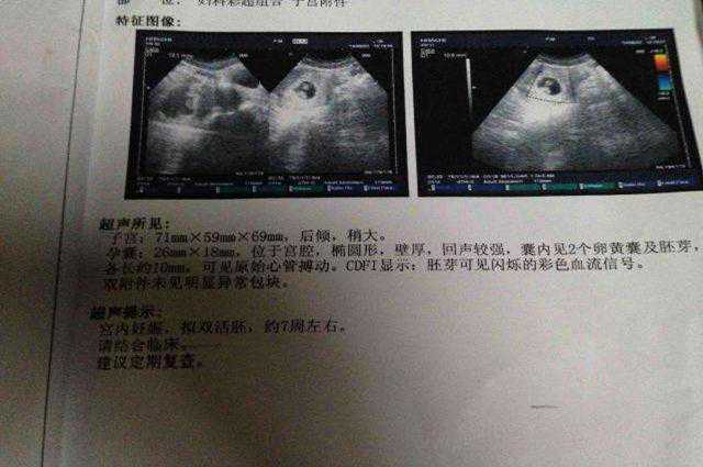 试管怀上双胞胎，孕四月却跪下哀求打掉，结果婆媳二人大打出手