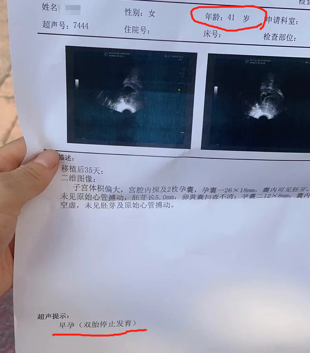 41岁准妈妈，多次试管怀孕后胎停，医生建议一定要做这些检查