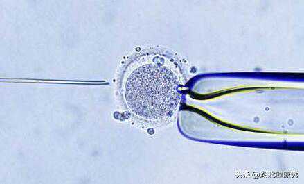 打算做试管婴儿，却连这6个常识都不知道，劝你还是先别去了
