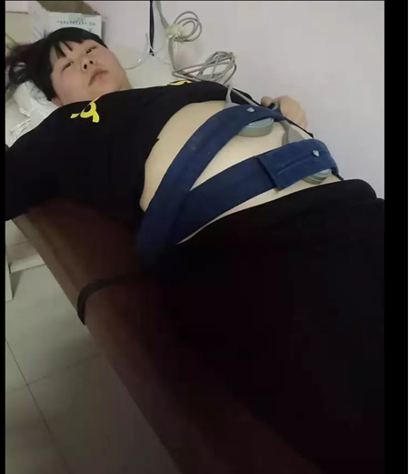 孕妇因车祸流产两次，试管多次诞下宝宝，婴儿仅巴掌大，重770克