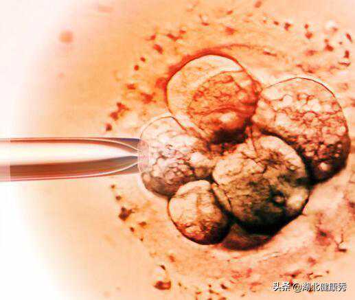 关于试管婴儿，大家听得最多的8个谣言，以后别再被忽悠了