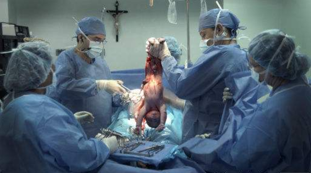 听说孕期梦到这几种动物，最容易生男娃