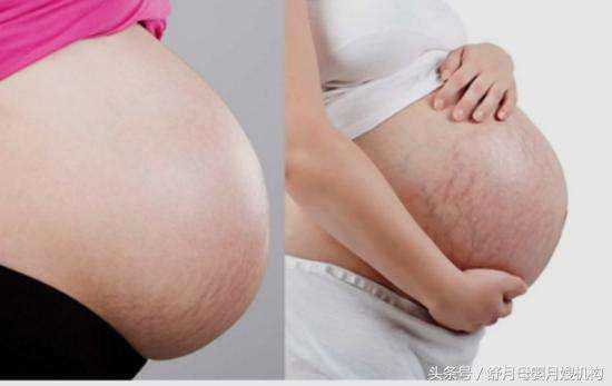 孕期如果有这5个反应，恭喜！可能是男孩哦